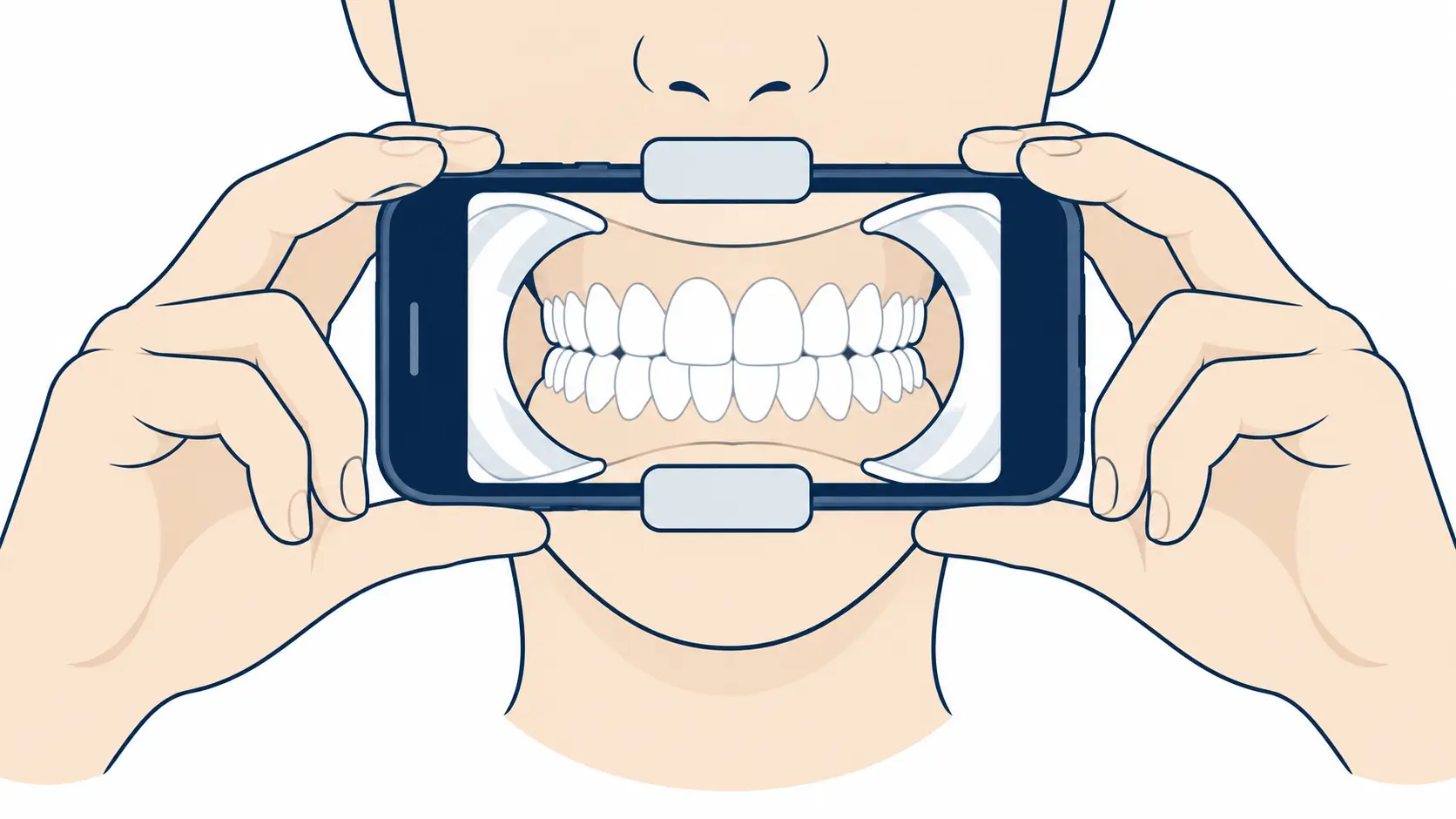 Illustration: Dental Monitoring